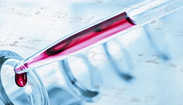 MDR 歐盟醫療器材法規-品質管理系統研習課程 